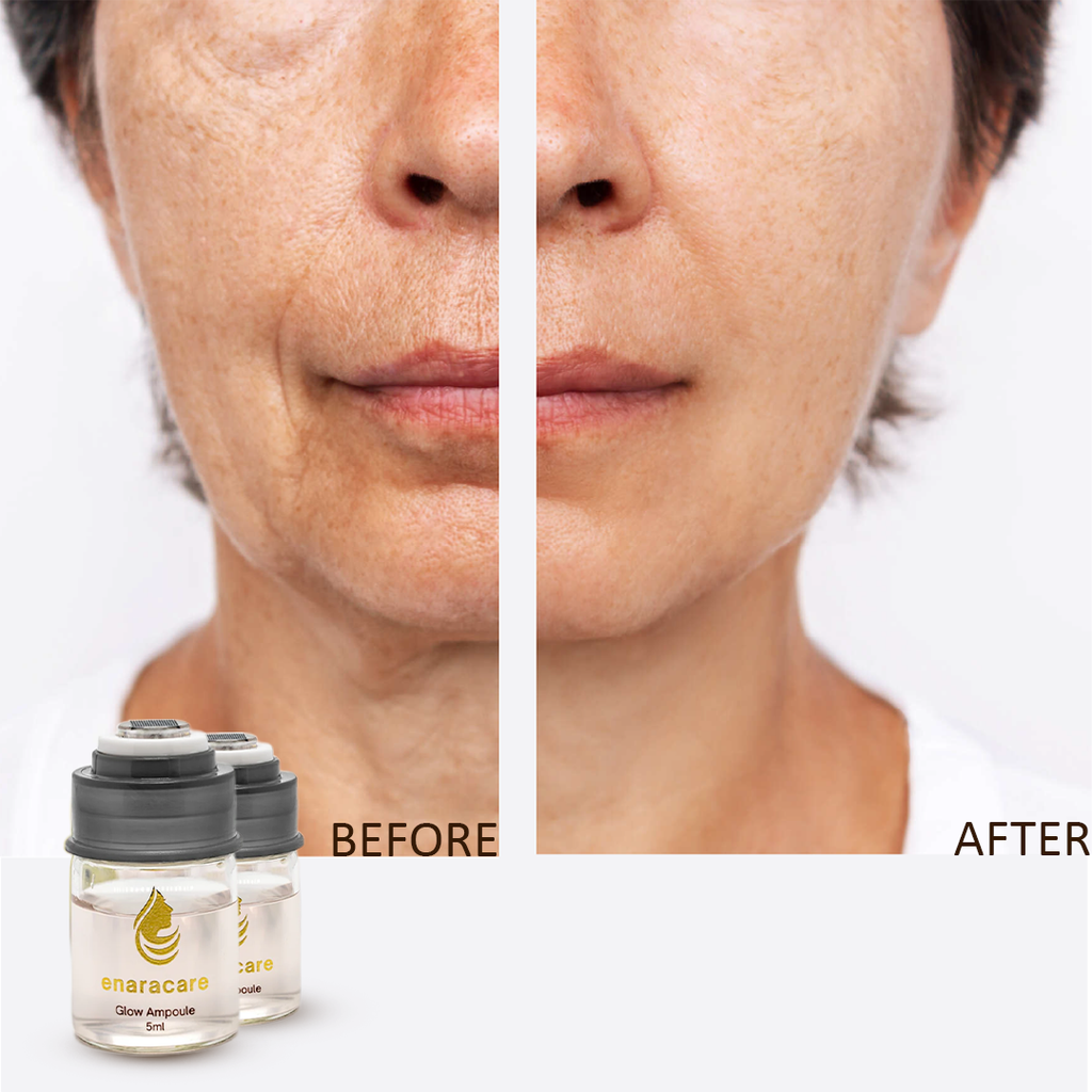 EnaraCare™ - Advanced Skin Rejuvenation Serum with PDRN & EGF