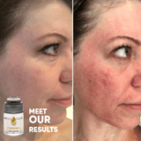 — Rebecc, 47 years old